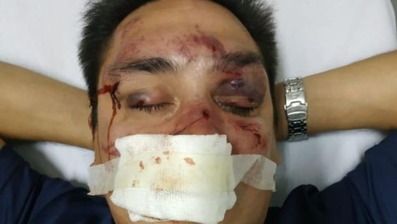 Integrantes de la barrabrava de Racing desfiguraron a un periodista partidario