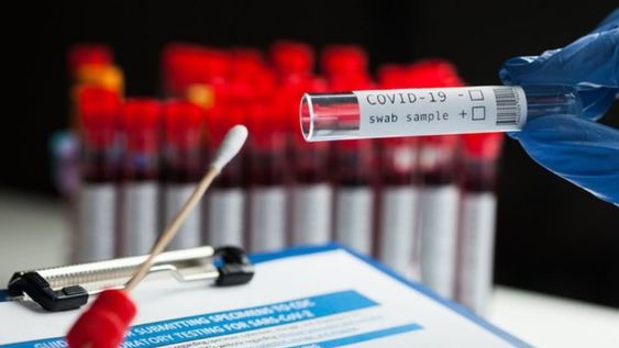 Investigadores de Harvard piden más pruebas para detectar covid-19 rápidas y baratas aunque sean imprecisas