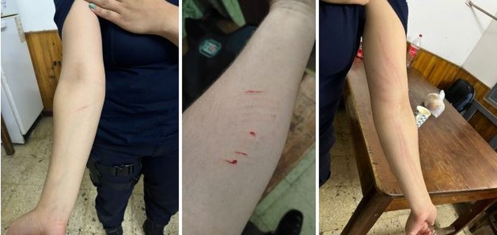 El Ministerio de Seguridad aseguró que varios policías resultaron lesionados durante los incidentes con manifestantes durante la marcha universitaria en San Rafael.