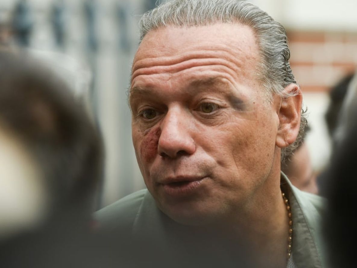 Sergio Berni realizó una polémica comparación respecto a la agresión que recibió. Foto: Clarín