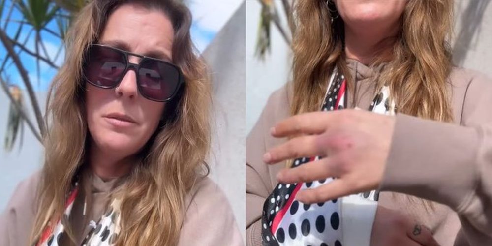 Dani La Chepi terminó herida al separar a su perra de una pelea.