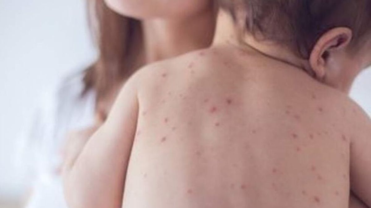 "¡Vacuná a tu hijo contra el sarampión, ya!": el pedido del ministro de Salud por el brote en Argentina
