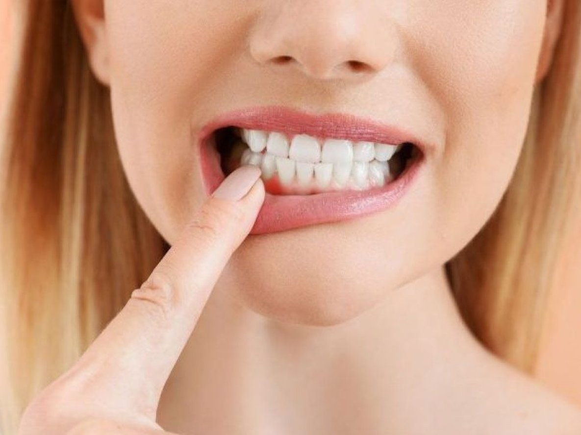 Cuál es el ingrediente ideal y económico para mejorar la limpieza de tu boca