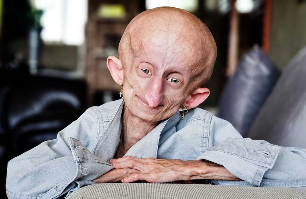 La influencer sudafricana falleció a sus 19 años, tras batallar contra una dura enfermedad.