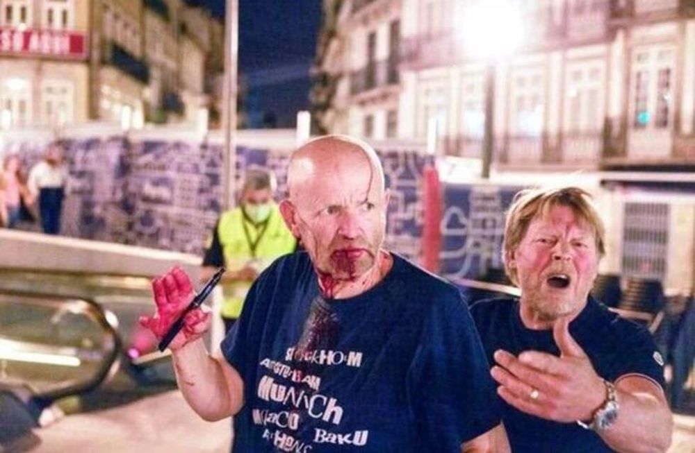 Un herido fue el saldo del enfrentamiento entre hinchas violentos de Manchester City y Chelsea.