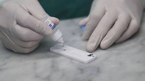 La ANMAT autorizó la venta de test rápidos para detectar coronavirus.