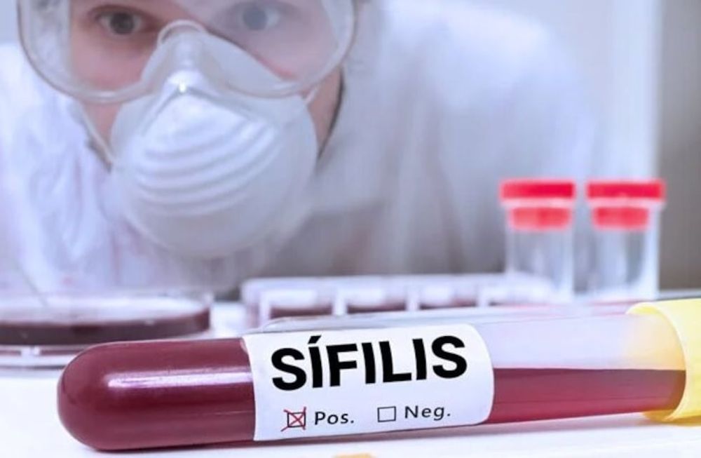 El aumento exponencial de las infecciones por sífilis llevó al Ministerio de Salud de Mendoza a implementar un curso de aprendizaje obligatorio para los trabajadores de la salud. . Foto archivo: web