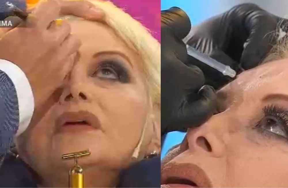 Carmen Barbieri se puso bótox en vivo.