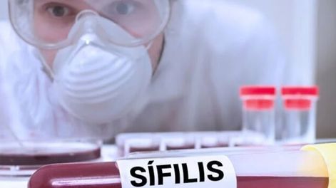 Los incrementos tan apresurados de sífilis pueden convertirse en un grave problema nacional en el mediano plazo. | Foto: archivo