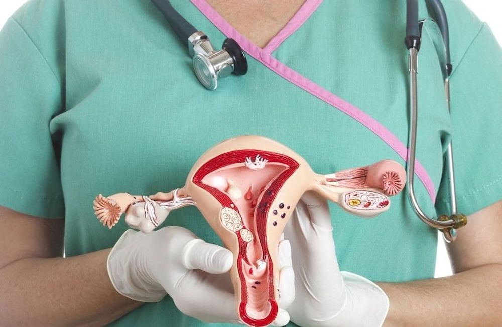 6 síntomas de alarma para la detección temprana del cáncer de ovario