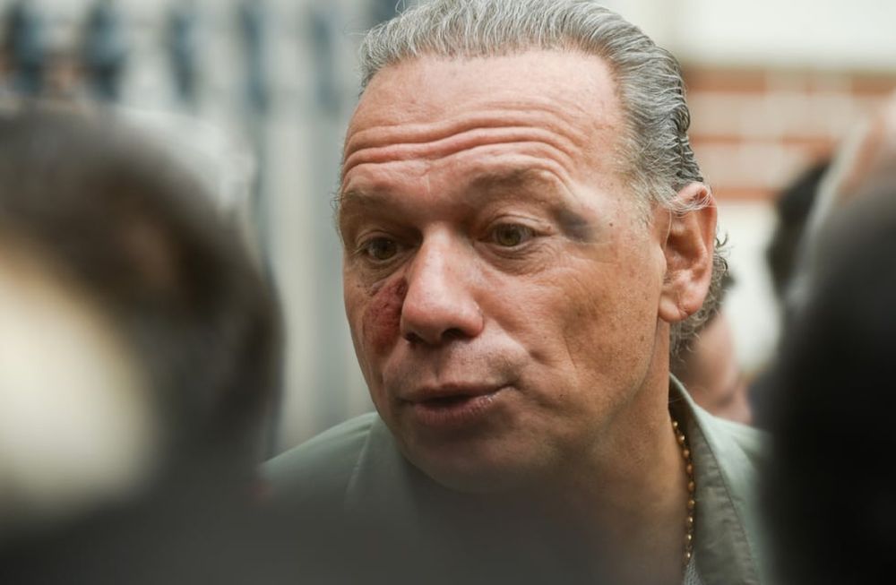 Sergio Berni realizó una polémica comparación respecto a la agresión que recibió. Foto: Clarín