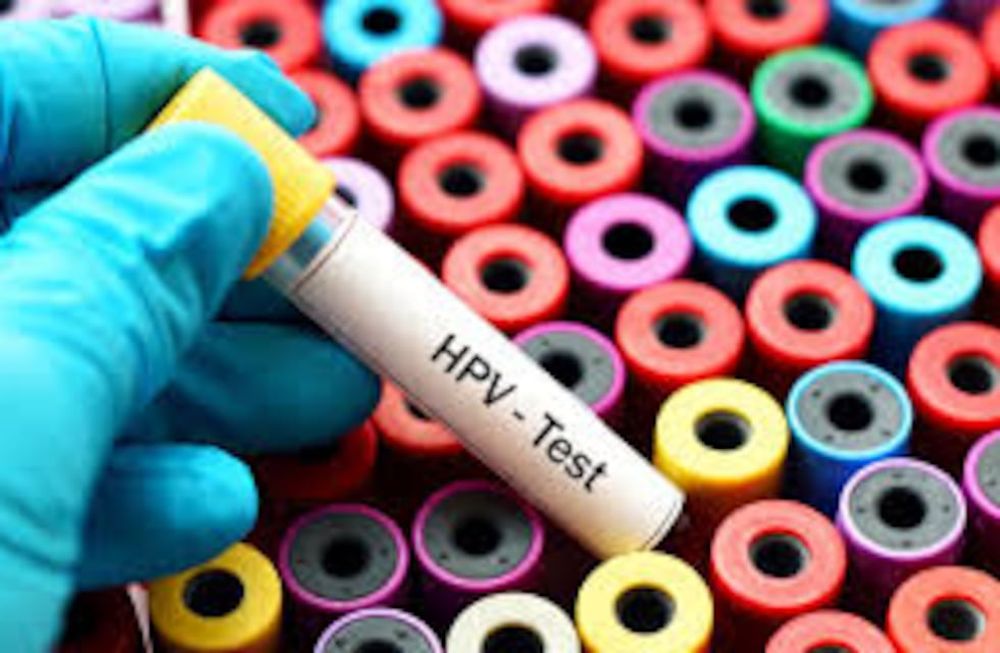 Test para detectar el Virus del Papiloma Humano