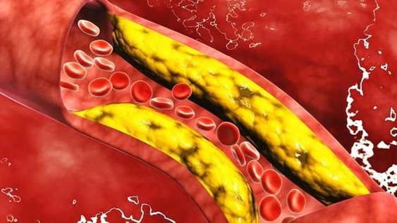 3 alimentos que desinflaman las arterias y reducen el colesterol malo, según la ciencia