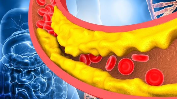 3 alimentos comunes que ayudan a reducir el colesterol y cuidar el sistema cardiovascular