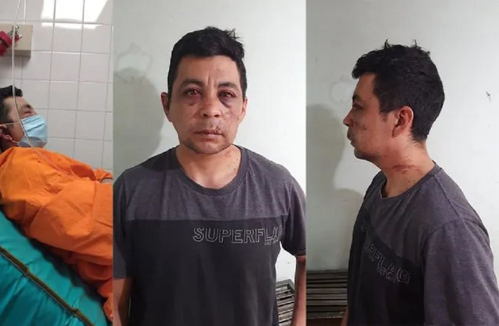 Daniel, el enfermero atacado en Neuquén - Gentileza / LM Neuquén