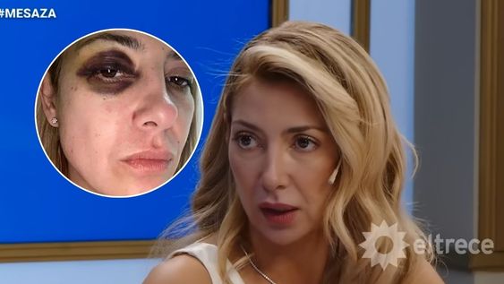 Las revelaciones de Fabiola Yañez sobre la noche que Alberto Fernández la golpeó: Dijo que fue involuntario.
