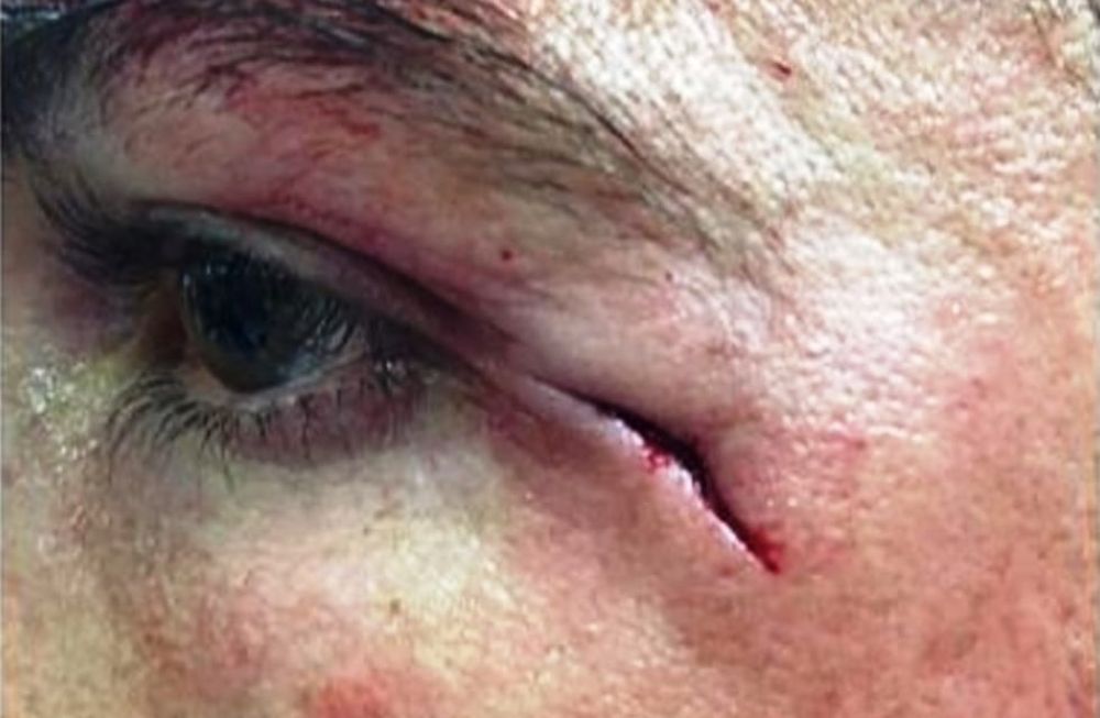 Mirá como le quedó el rostro a Cristiano tras el corte que sufrió por una patada