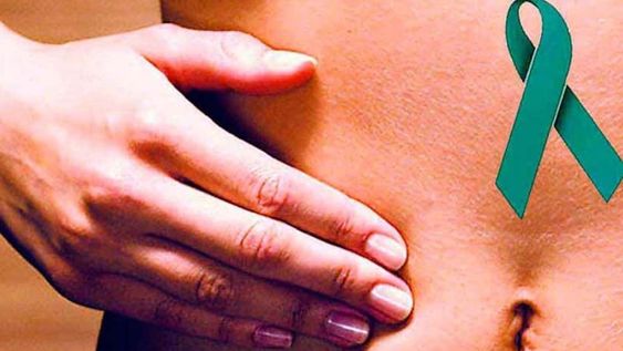 Cáncer de ovario. Factores de riesgo: la edad y el historial familiar, ser portador de anormalidades o mutaciones en los genes BRCA1 o BRCA2 aumenta la posibilidad de padecer el cáncer (Semmexico.org).