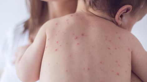 Los Andes | FJABAZMFUNG3HHJJX4QUK6N6KI.jpg?quality=75&smart=true&auth=70014716c8d81cfd3dc324568dd3a58b972fa1ac768dfb34a1fe958660f97494&width=980&height=640