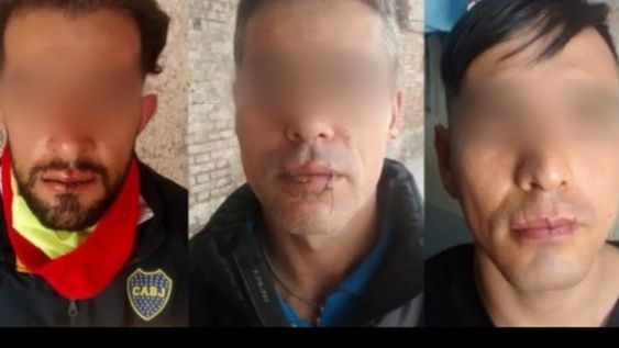 Presos mendocinos se cosieron la boca para protestar: piden domiciliaria