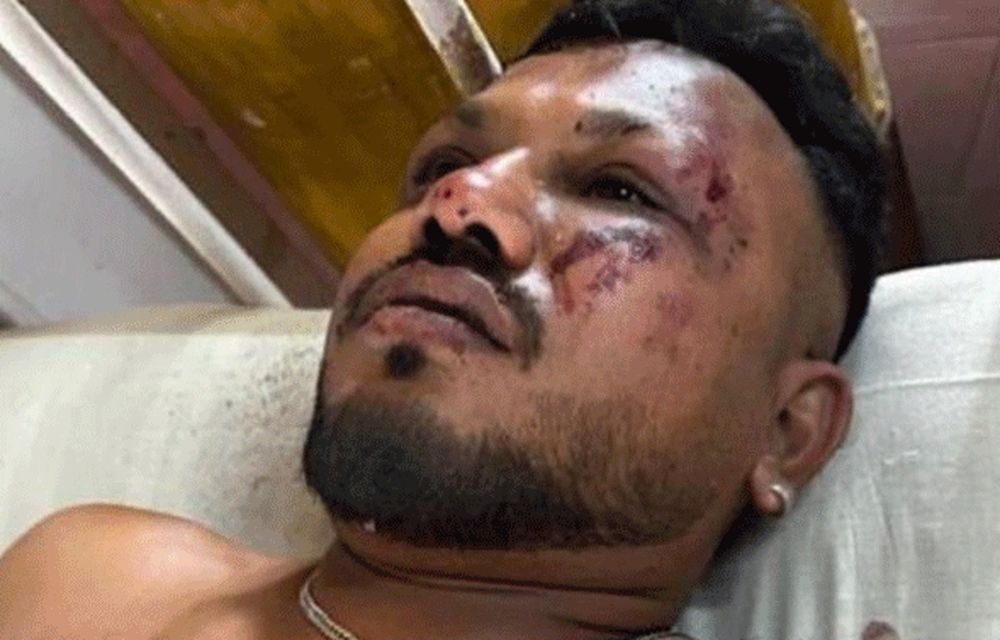 Ramesh Vishwakumar, pasajero sobreviviente de la tragedia de Air India