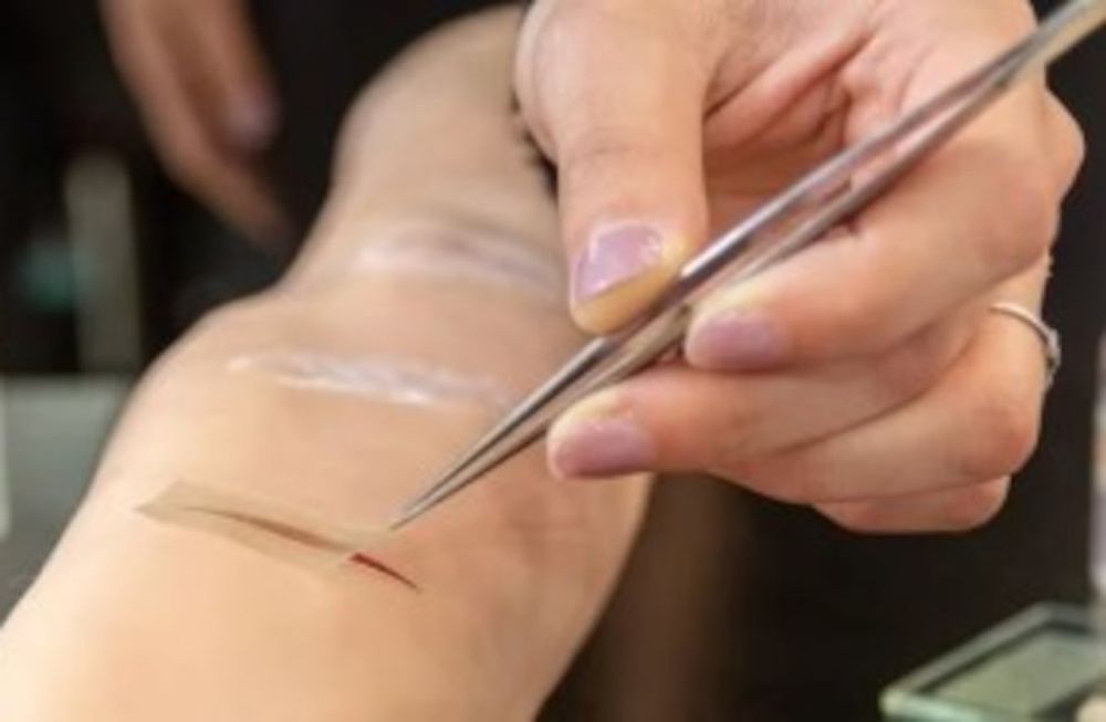 Un apósito inteligente para cicatrizar las heridas crónicas