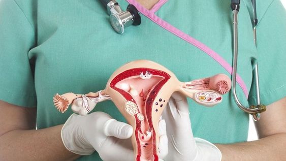 6 síntomas de alarma para la detección temprana del cáncer de ovario