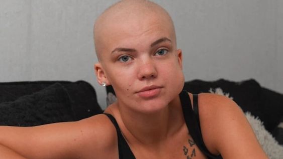 Kimberley Eccles (23) tiene cáncer y le avisaron por Zoom: pasó meses sin tratamiento por el Covid-19 - The Sun