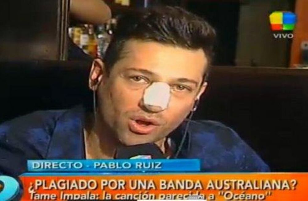 Pablito Ruiz se operó la cola y coqueteó con Rial