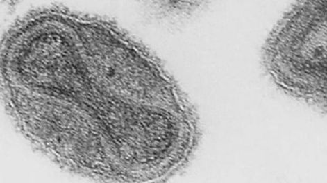 Los Andes | Todos los pacientes fueron atendidos y se encuentran en unidades especializadas en enfermedades infecciosas. Foto: Web / Los Andes