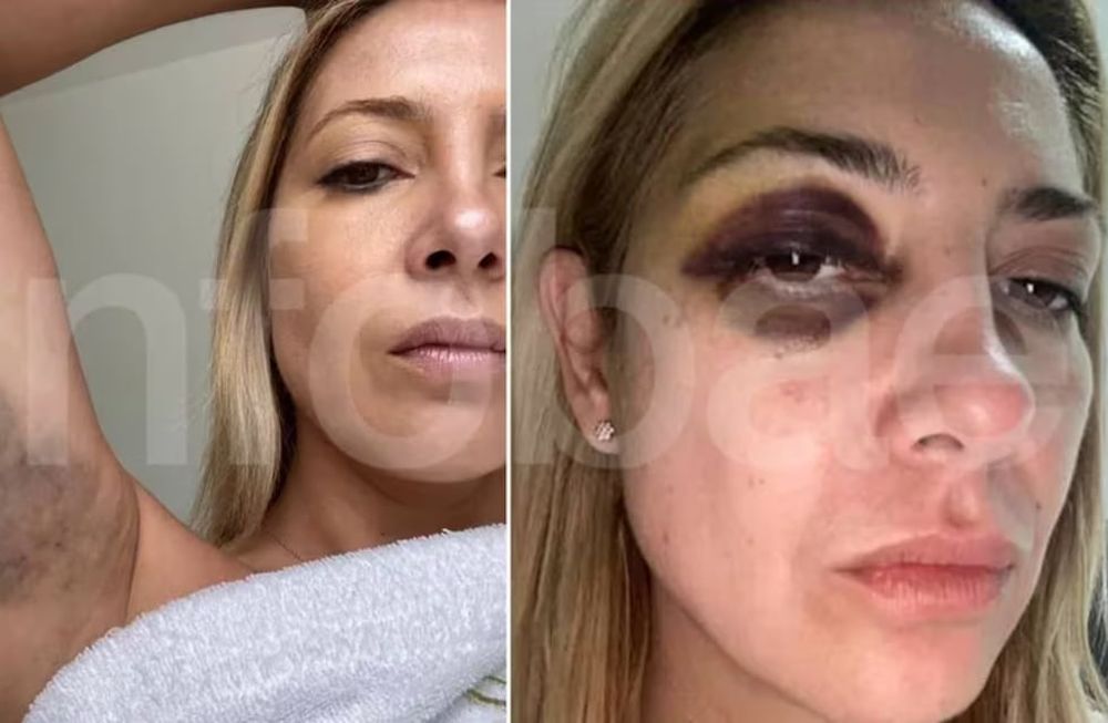 Las fotos de Fabiola Yañez que evidenciarían los maltratos de Fernández - Infobae