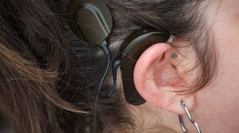 Los Andes | Zoe Albornoz extravió parte del equipo de su implante coclear arriba de un micro y necesita recuperarlo para volver a escuchar. Foto: Imagen ilustrativa.