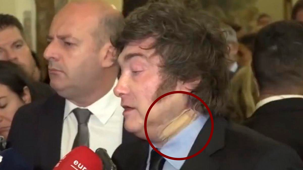 Javier Milei sufrió un accidente en España y explicó por qué llevaba una venda en el cuello.