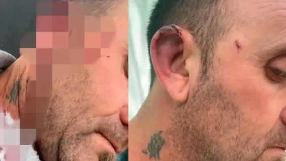 Escándalo en Entre Ríos: un concejal golpeó al intendente durante una reunión y terminó con el rostro ensangrentado.