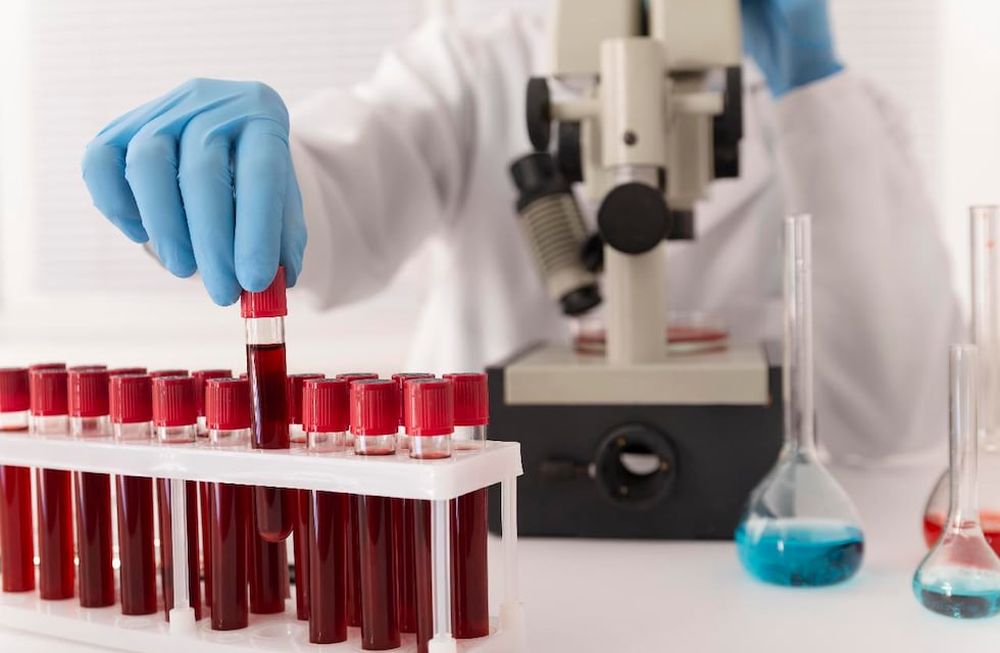 Bioquímicos advierten que faltarán insumos por el alto costo.