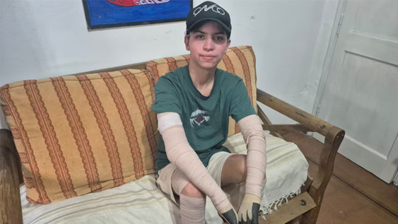 cordoba: un adolescente que sobrevivio a la explosion de su celular recibio el alta tras dos meses de lucha