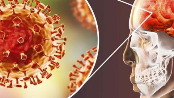 La rapidez en el diagnóstico de la meningitis es crucial para evitar daños graves y permanentes en el sistema neurológico