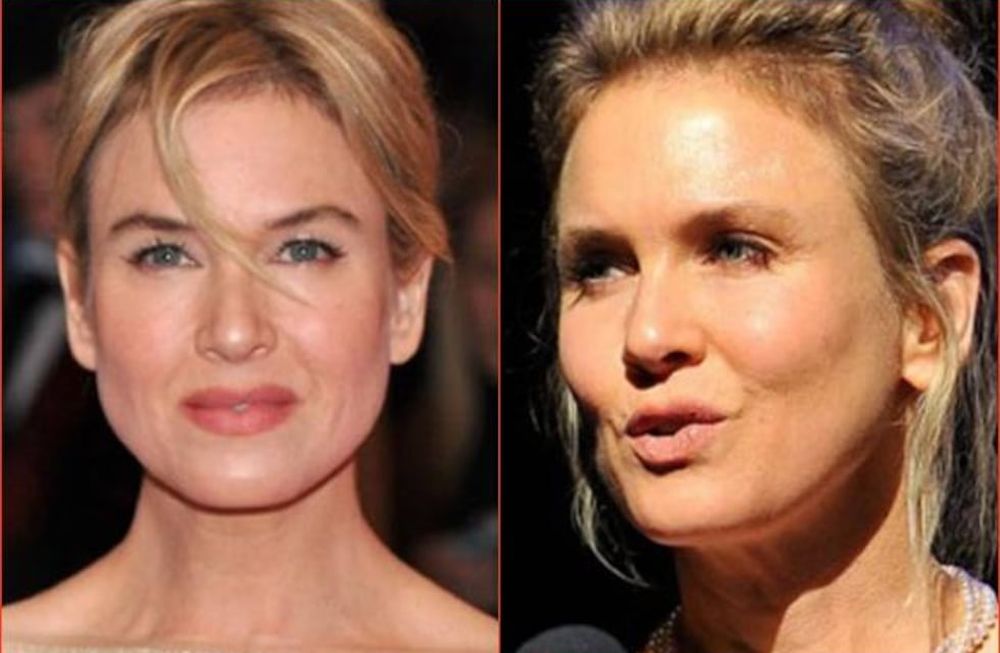 Renée Zellweger salió a explicar qué le pasó en la cara