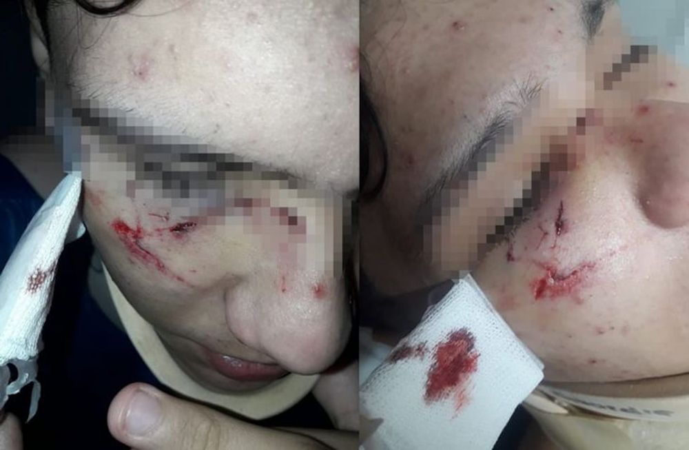 Santiago sufrió múltiples herida y debió ser llevado de urgencia al Hospital. Foto: Gentileza