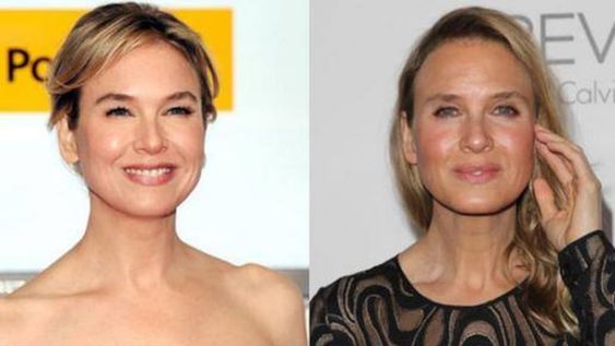 Así quedó Renée Zellweger después de una catarata de cirugías