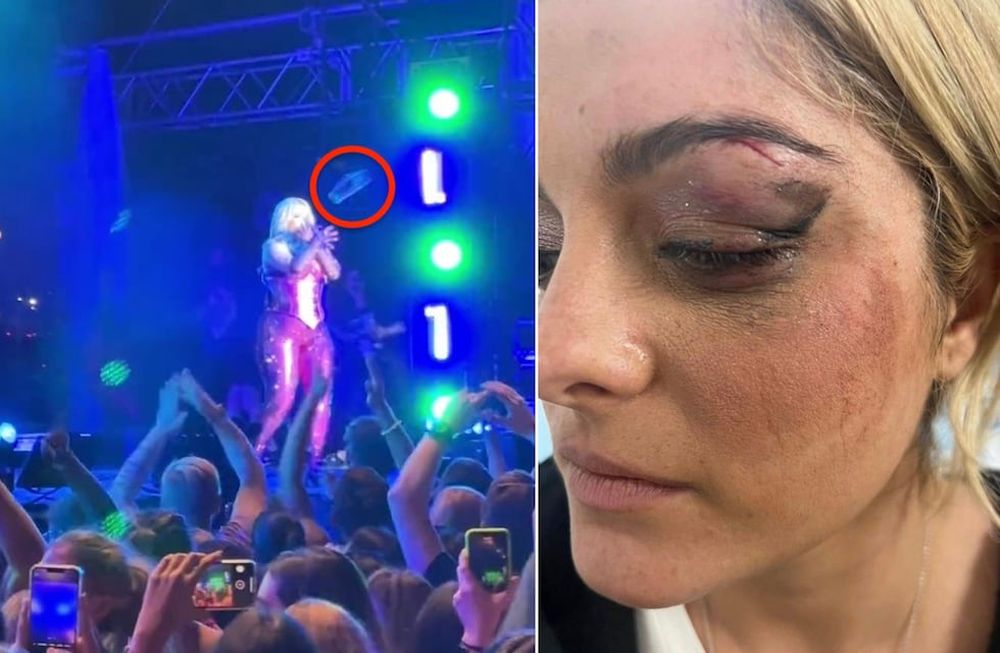 Agredieron en un show en vivo a la artista Bebe Rexha arrojándole un celular en la cara en Nueva York.