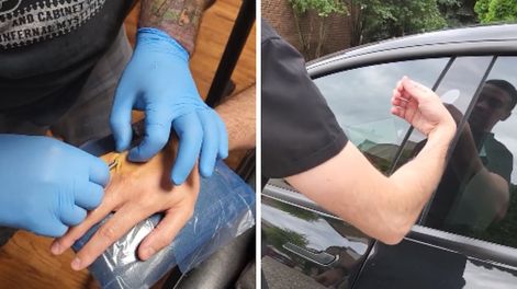 Un hombre se implantó las llaves de su Tesla en la mano.