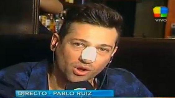 Pablito Ruiz se operó la cola y coqueteó con Rial