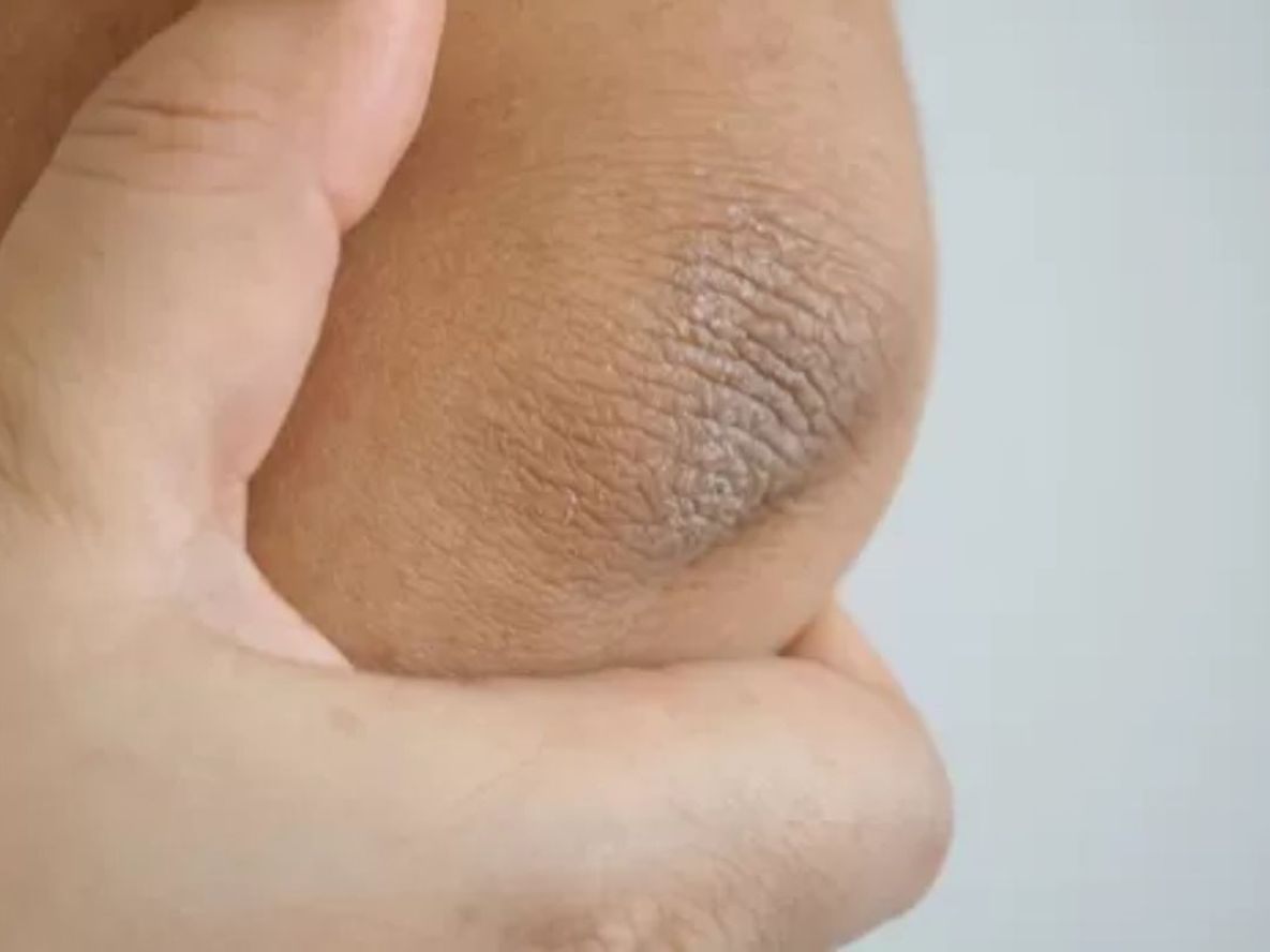 Cómo tener los codos suaves e hidratados solo con 2 ingredientes que tenés en tu cocina