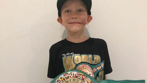 El Consejo Mundial de Boxeo (CMB) entregó el cinturón de campeón honorario a Bridger Walker, el niño que salvó a su pequeña hermana del ataque de un perro.