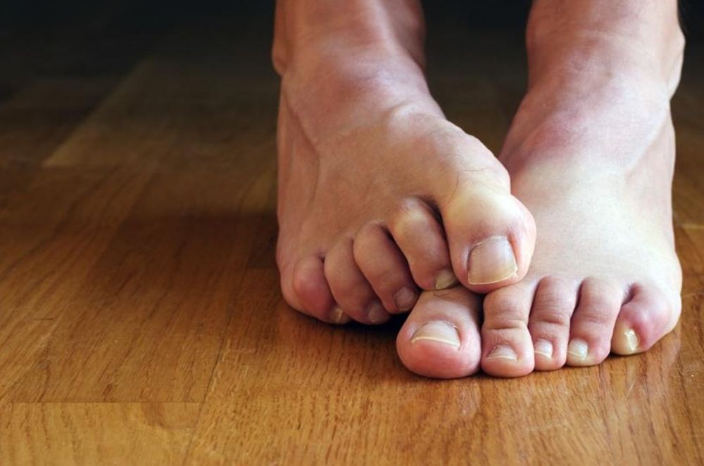 Las personas con diabetes enfrentan un mayor riesgo de desarrollar problemas en los pies debido a la neuropatía periférica y las complicaciones microvasculares.