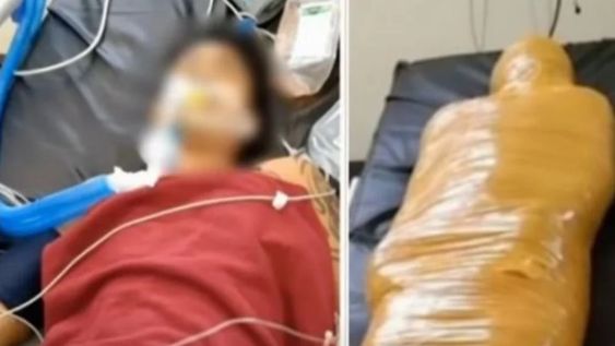 Merwin Fábregas murió en un hospital de Filipinas. Denuncian que lo confundieron con un paciente con Covid-19 y luego envolvieron su cuerpo con cinta de embalaje. Foto: Gentileza