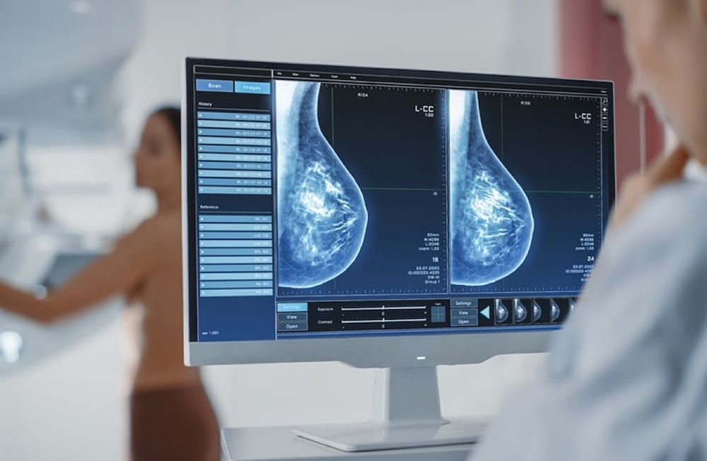 ¿Por qué es importante preservar la salud en las mujeres?