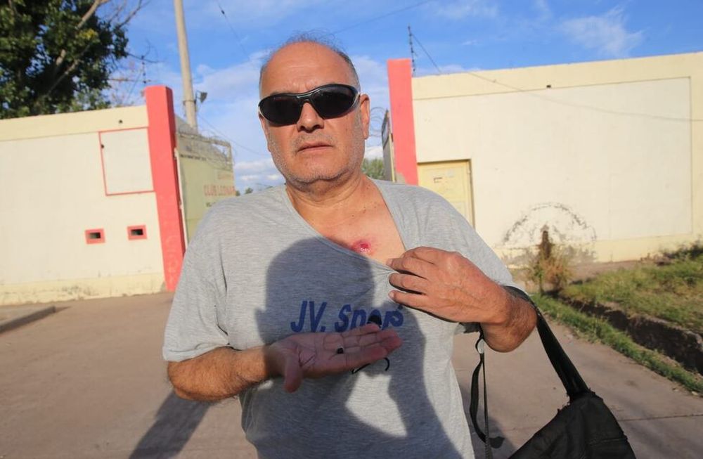 El periodista radial de FM Génesis y FM Libre sufrió el impacto de un balazo de goma en su pecho. / Gentileza.