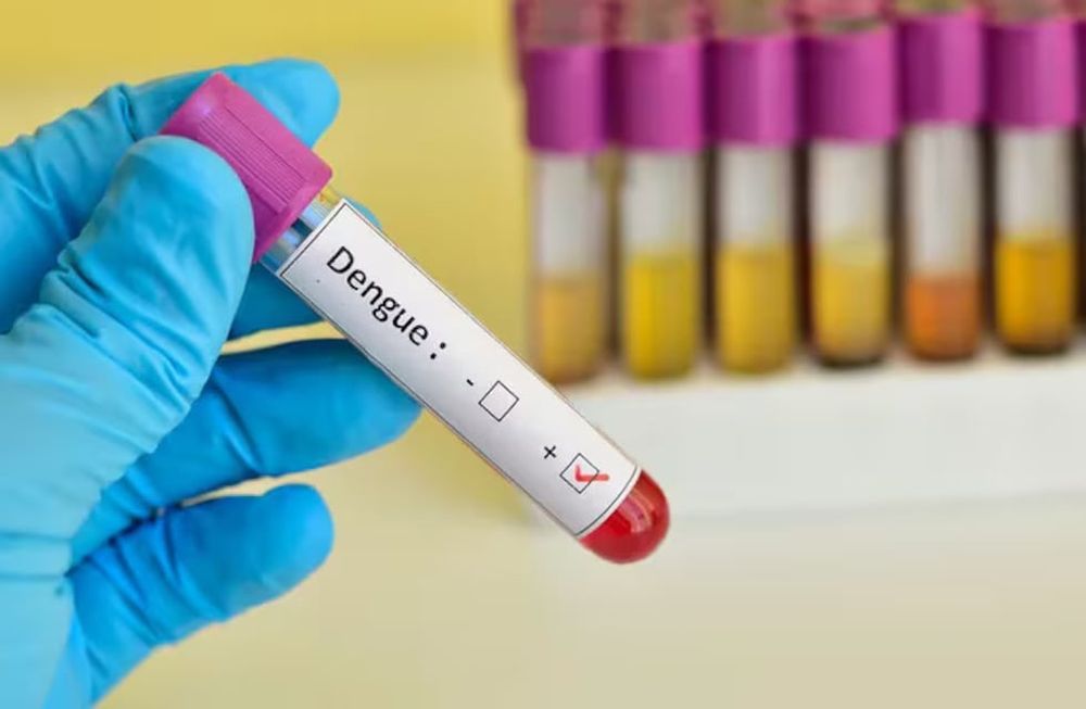 Circulación del virus del dengue en Argentina.